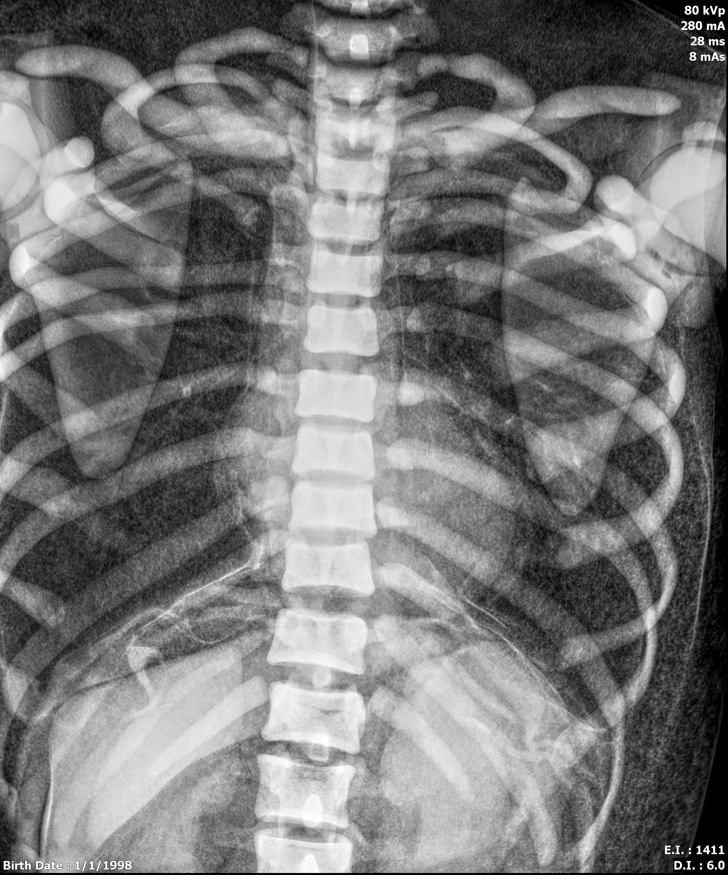 X-Ray Scans