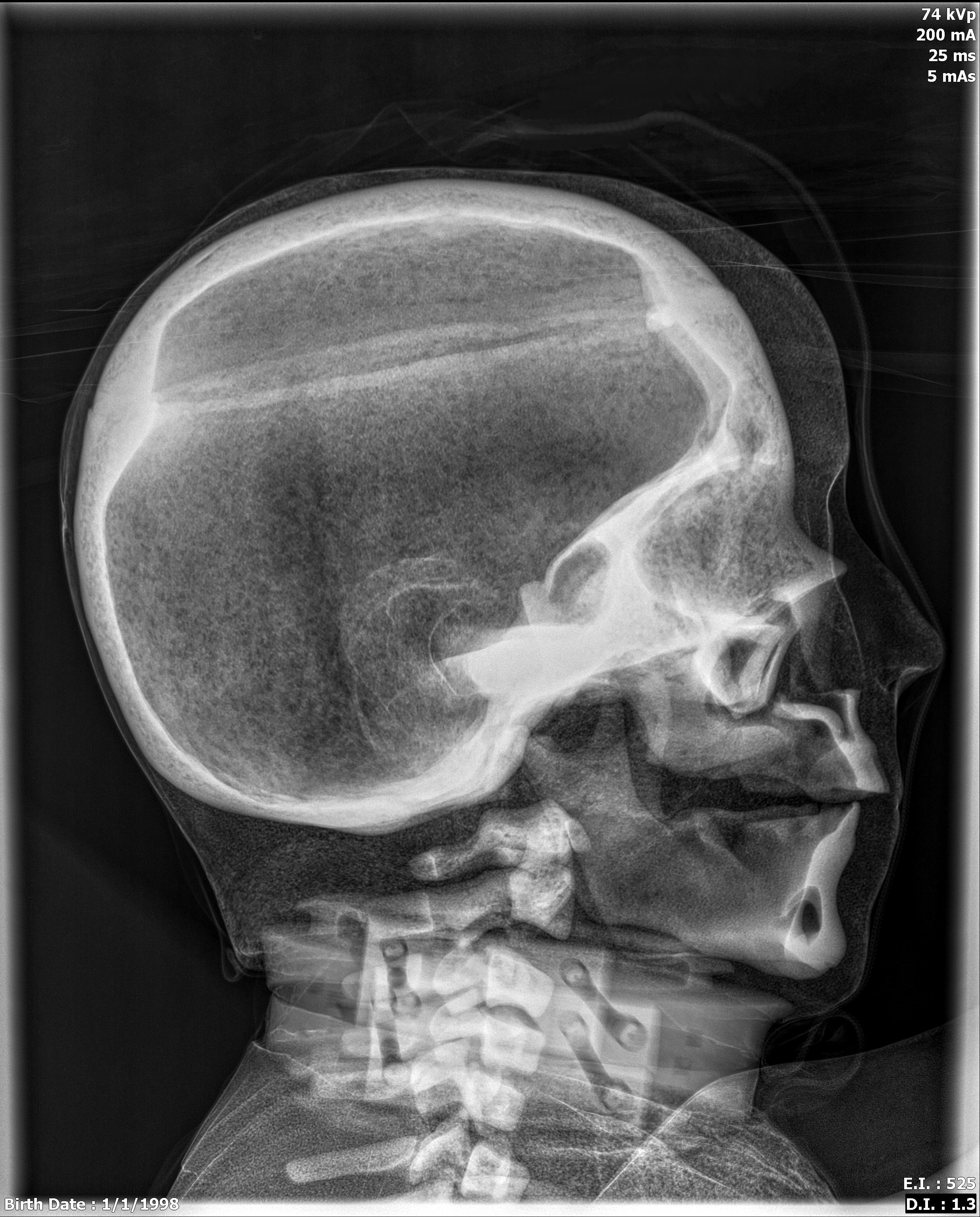 X-Ray Scans