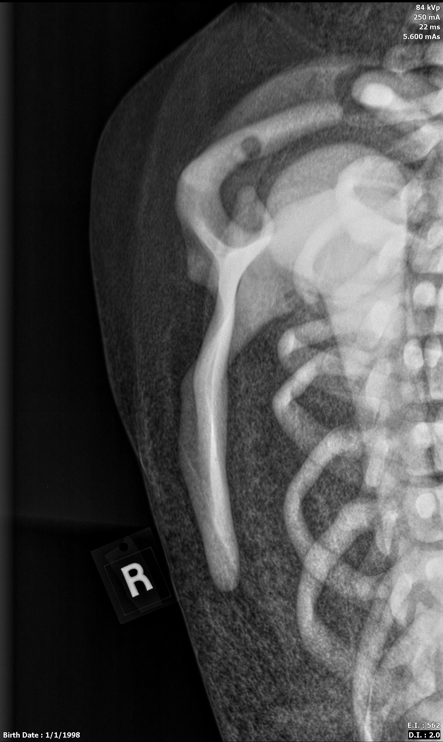X-Ray Scans