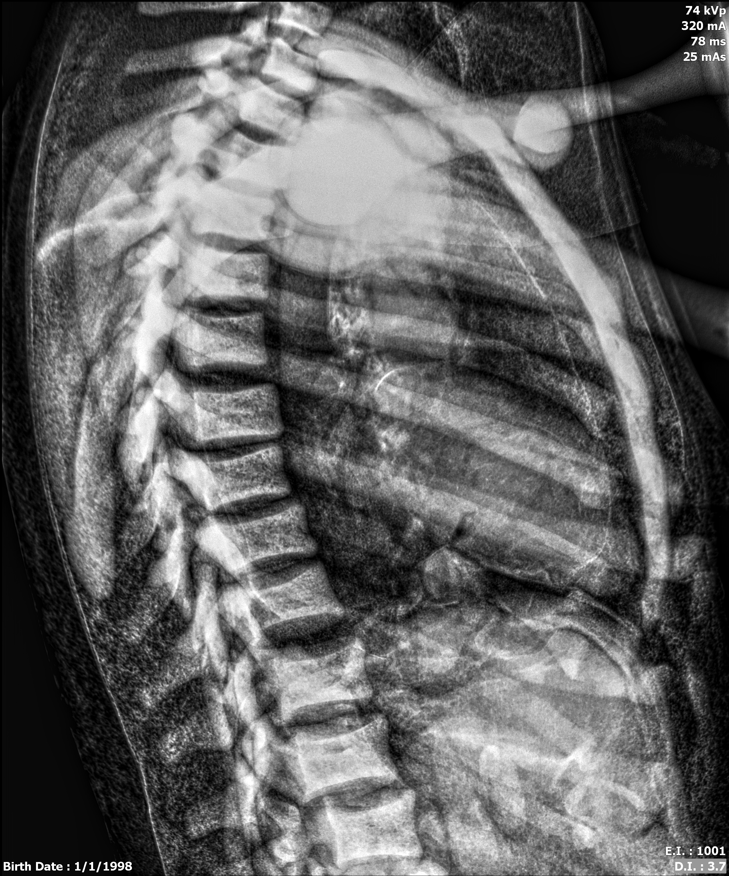X-Ray Scans