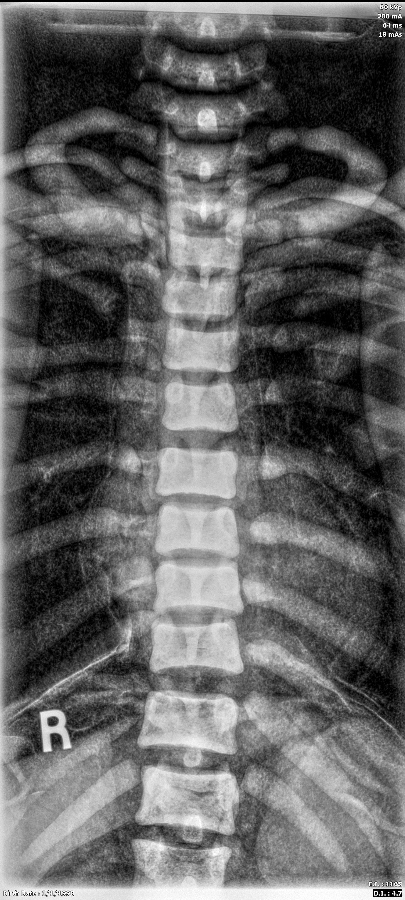 X-Ray Scans