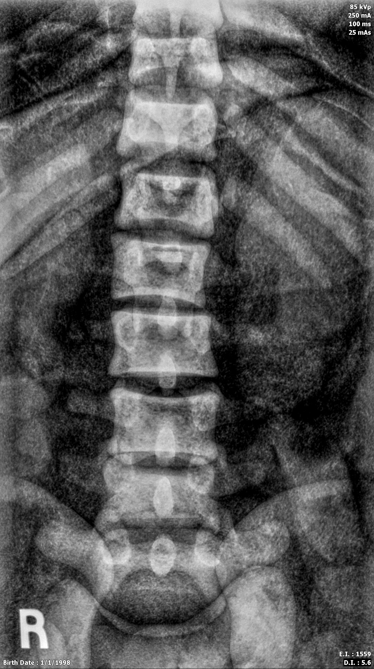X-Ray Scans
