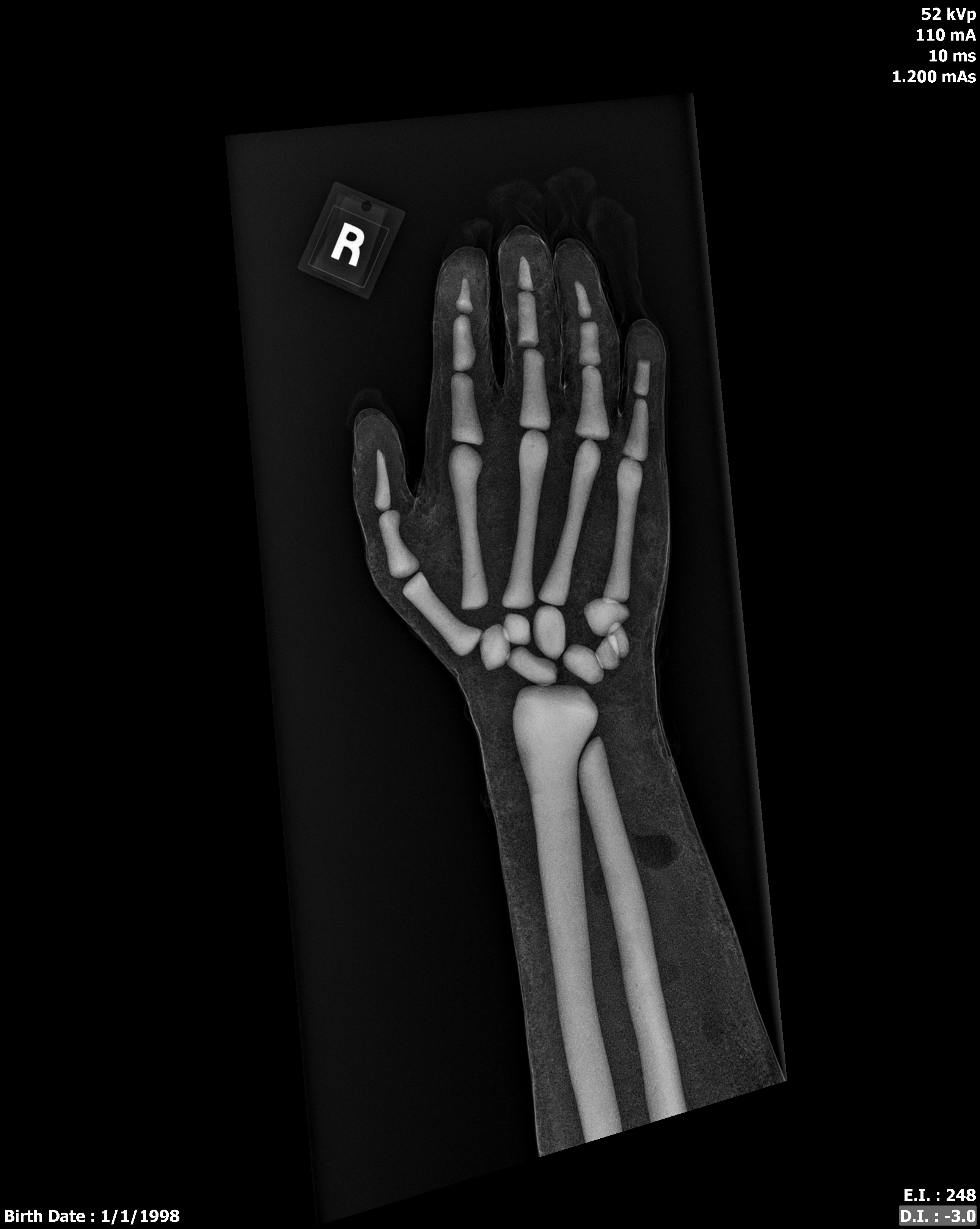 X-Ray Scans