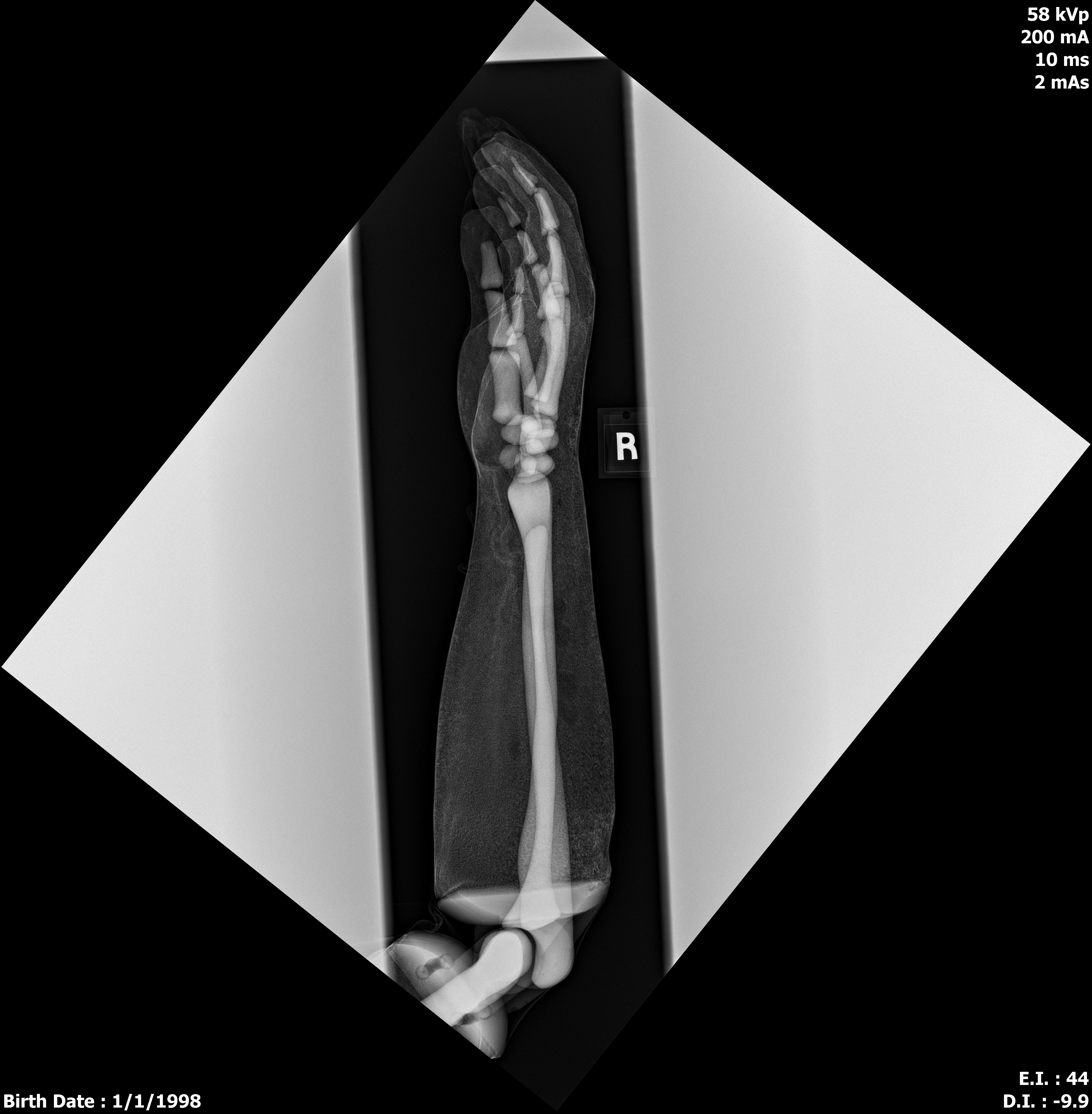 X-Ray Scans