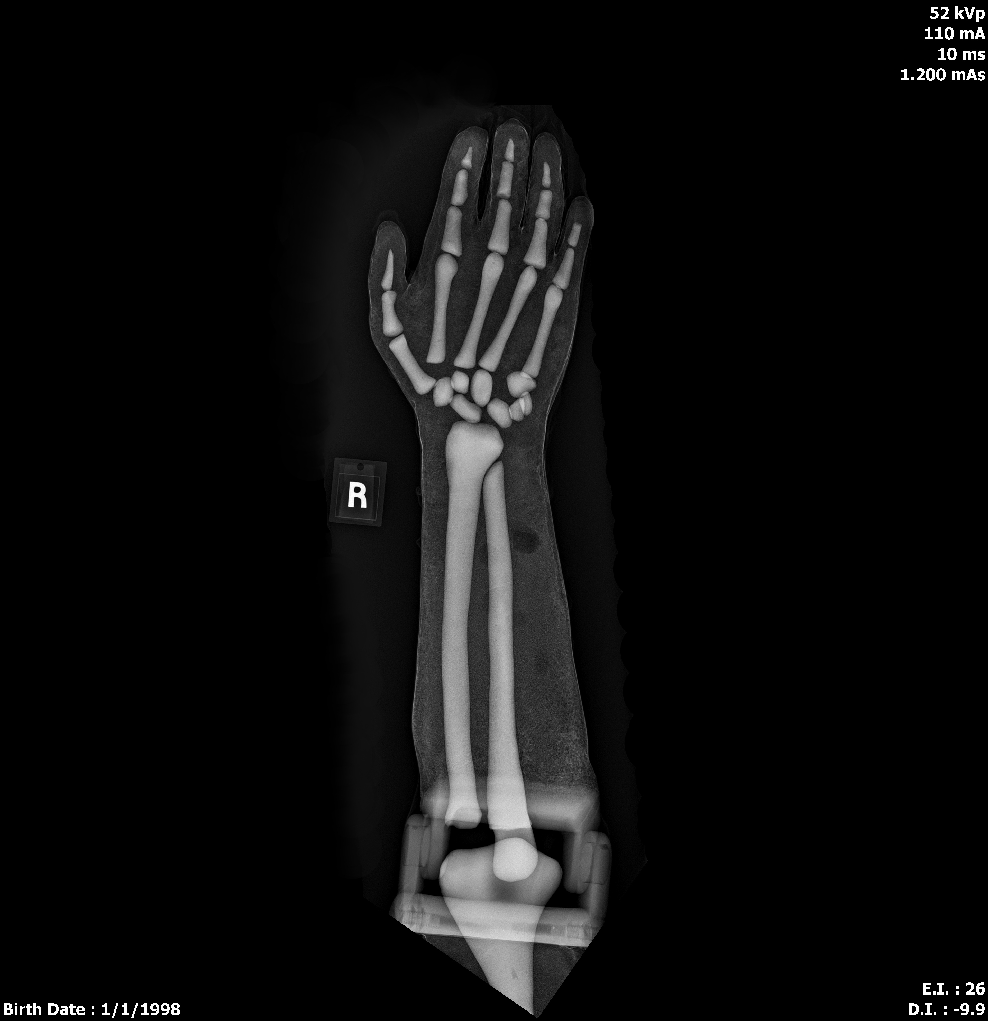 X-Ray Scans