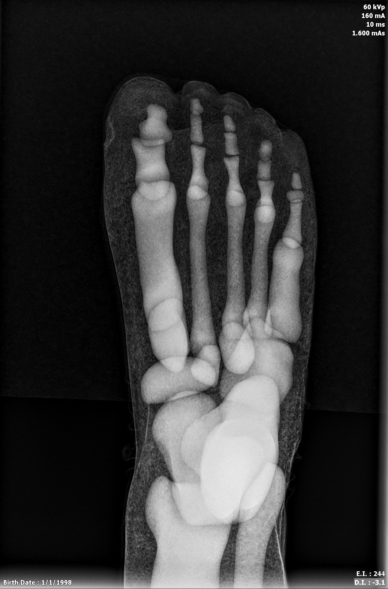X-Ray Scans