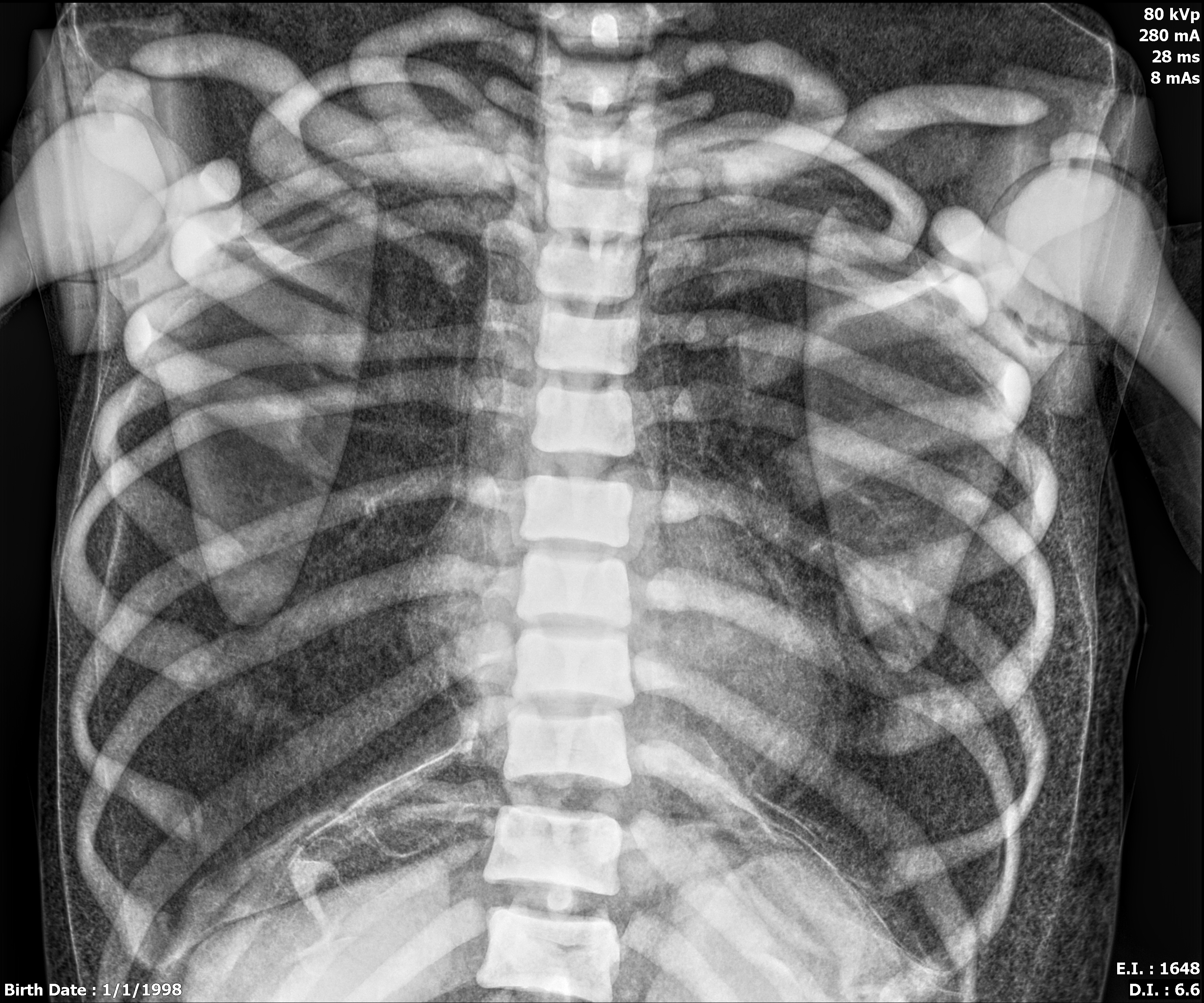 X-Ray Scans