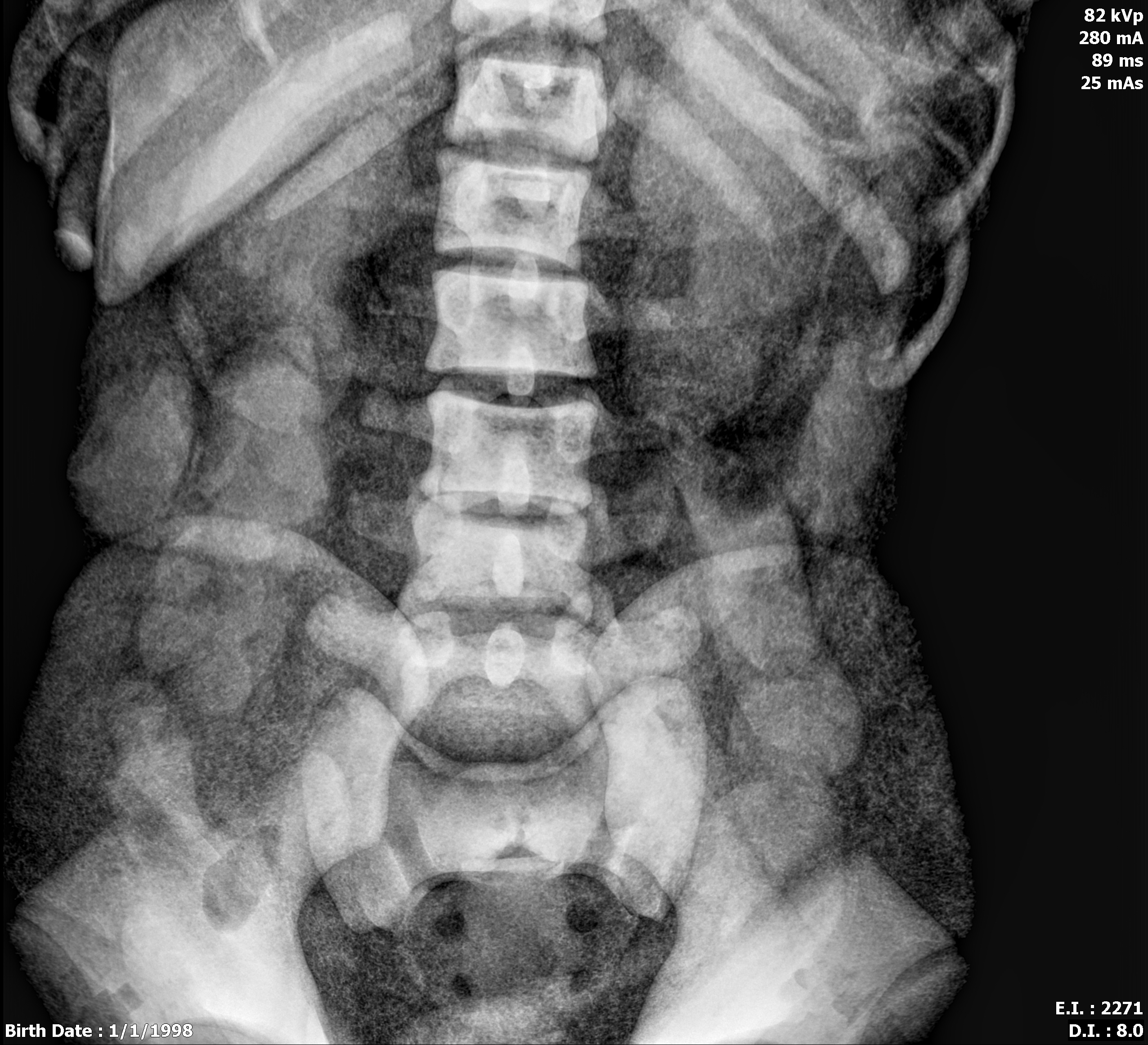 X-Ray Scans