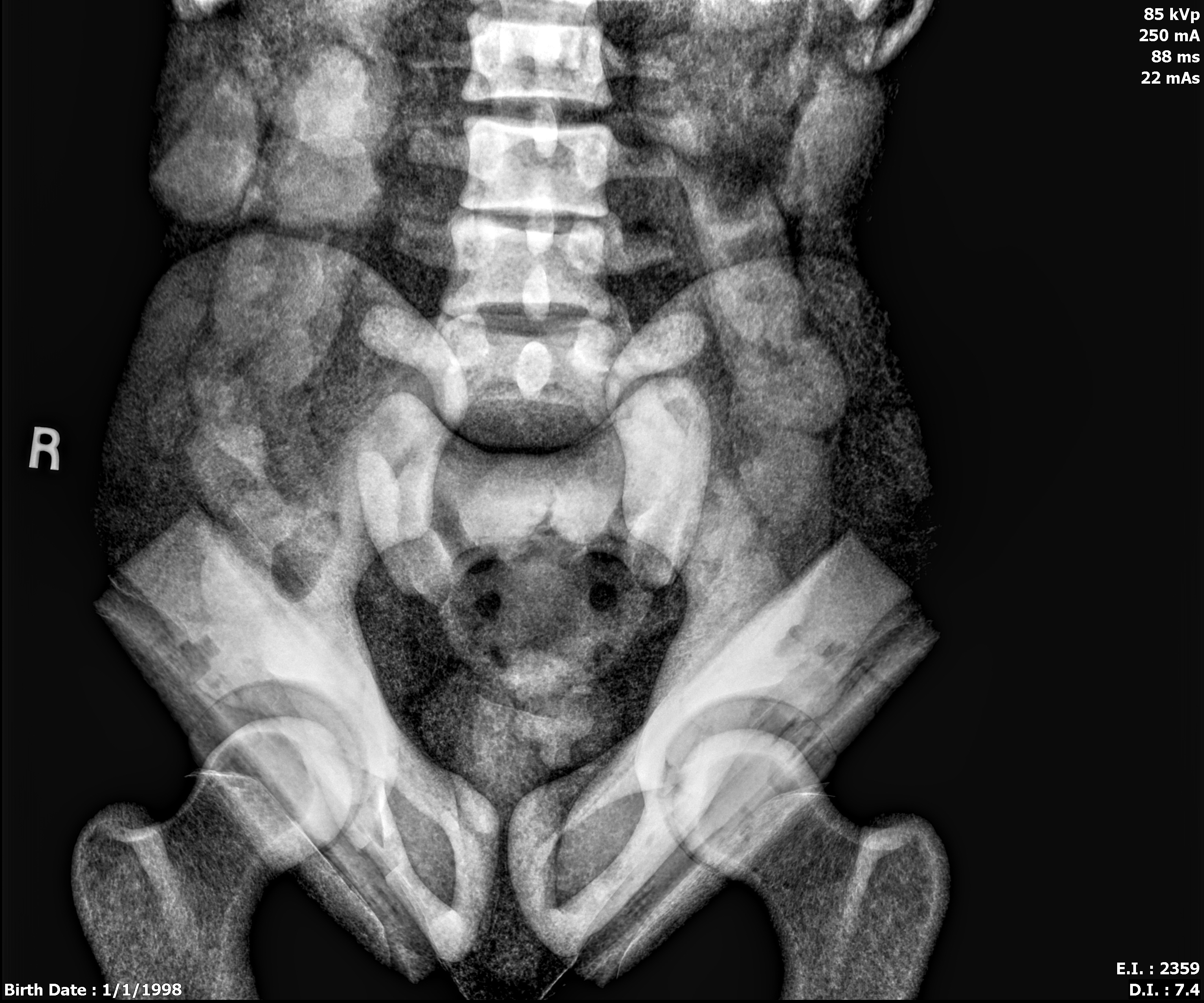 X-Ray Scans
