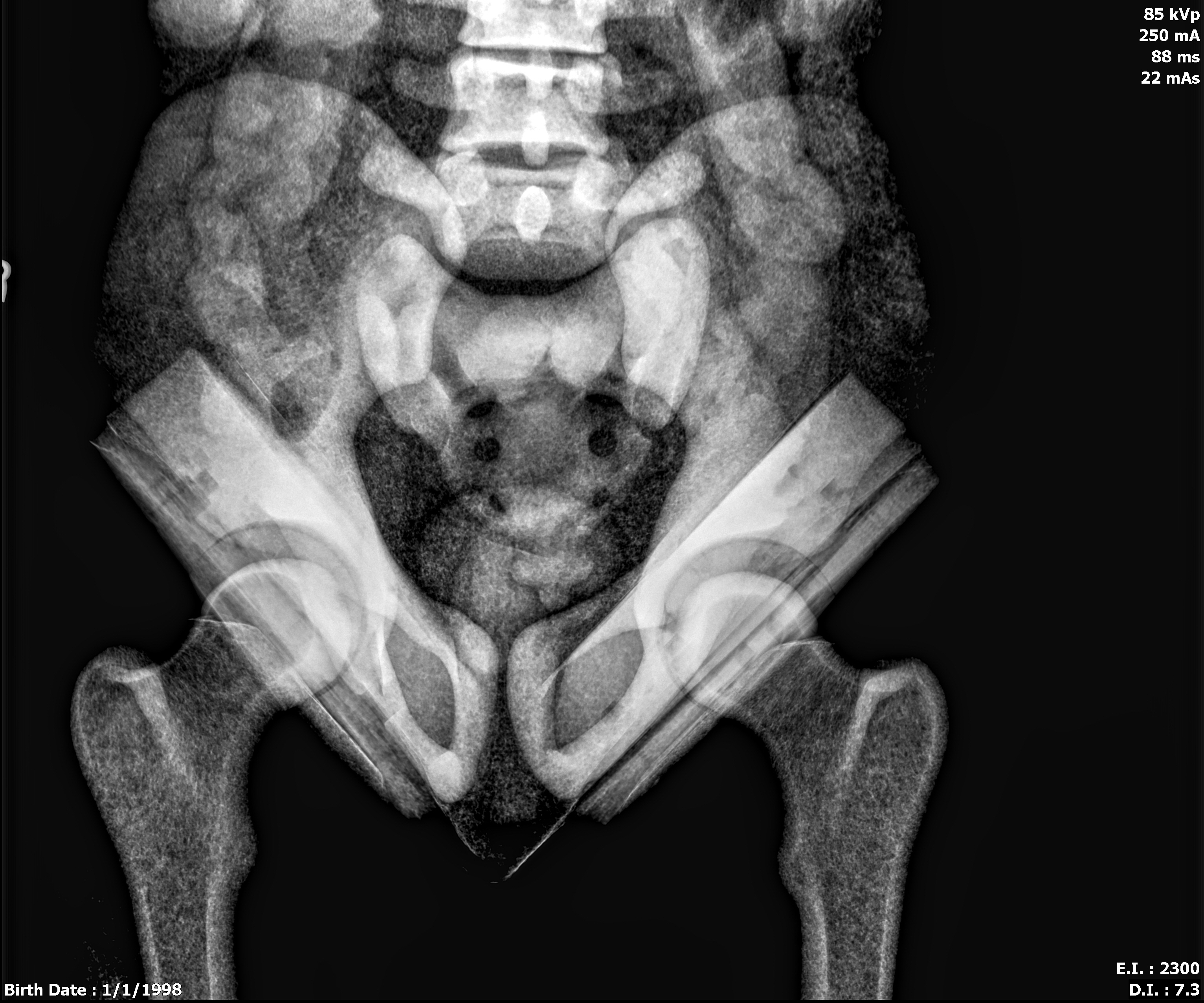 X-Ray Scans