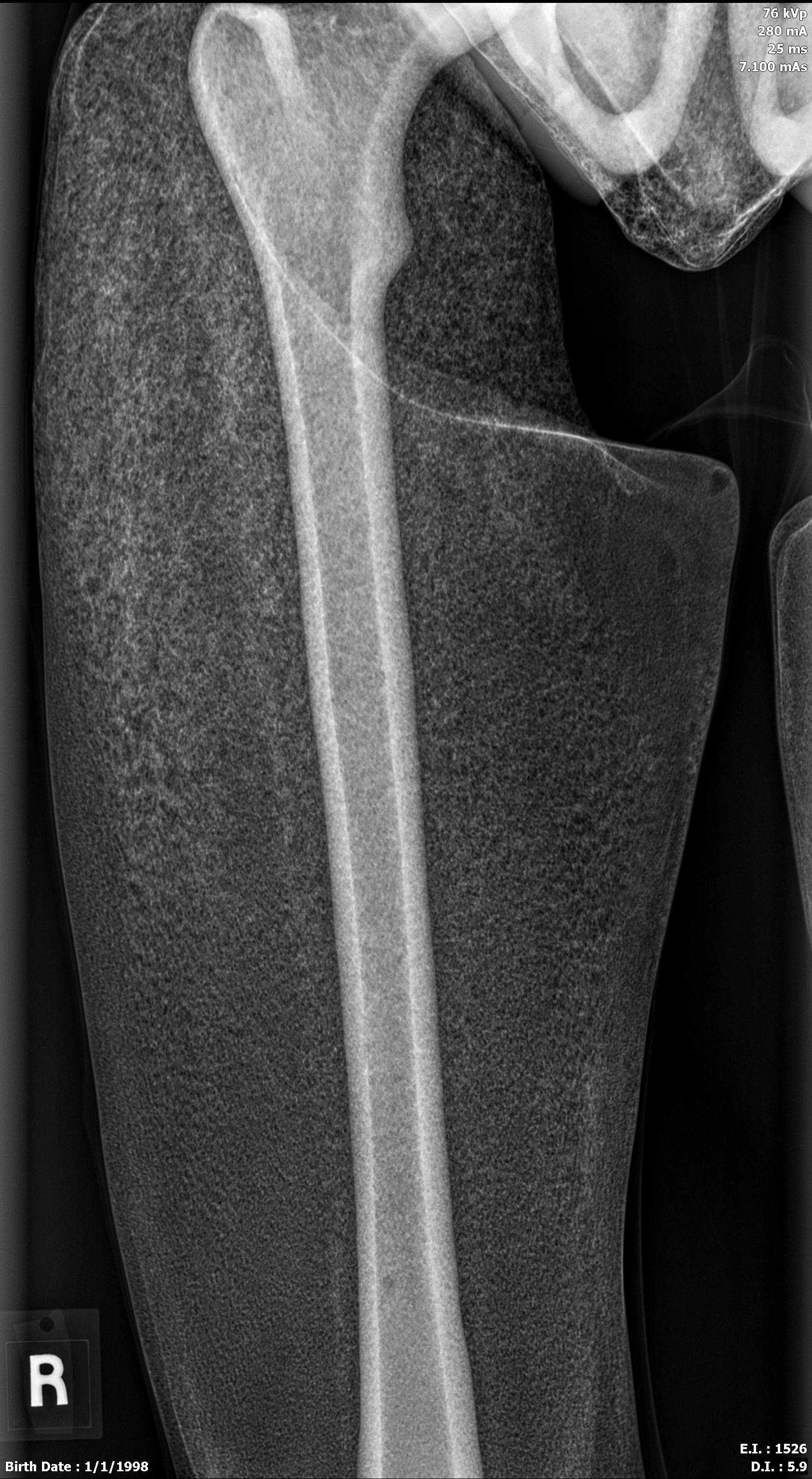 X-Ray Scans