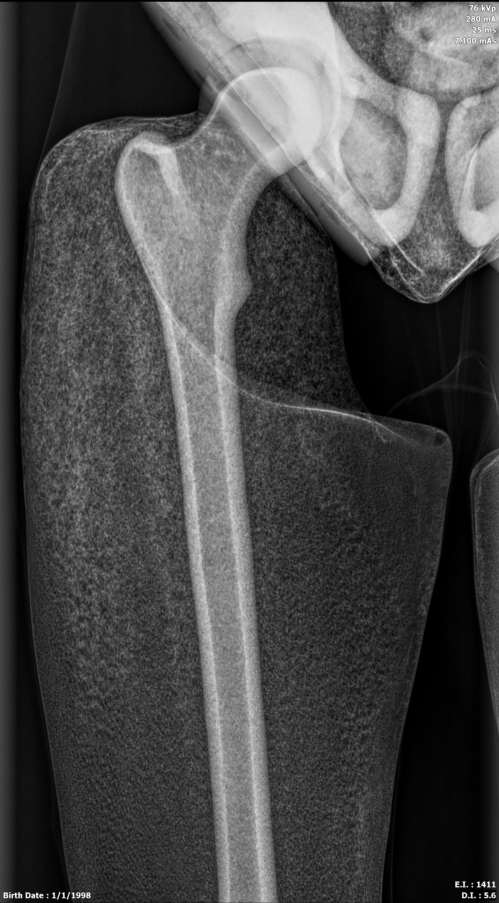 X-Ray Scans