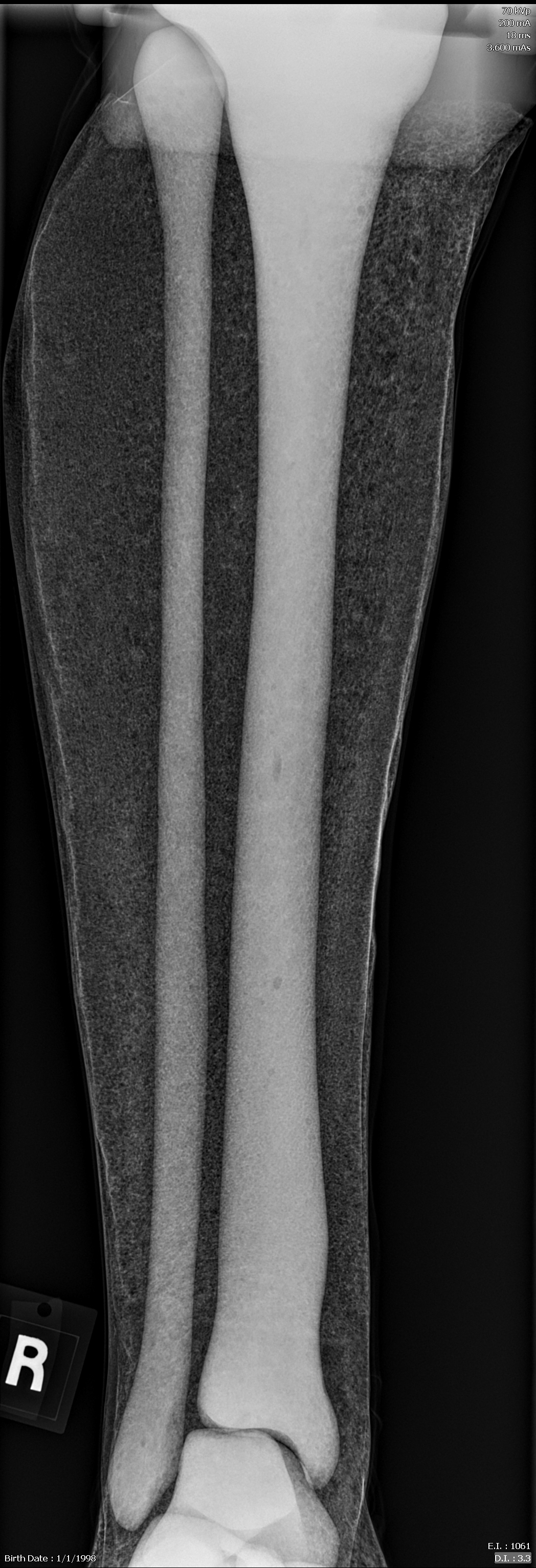X-Ray Scans