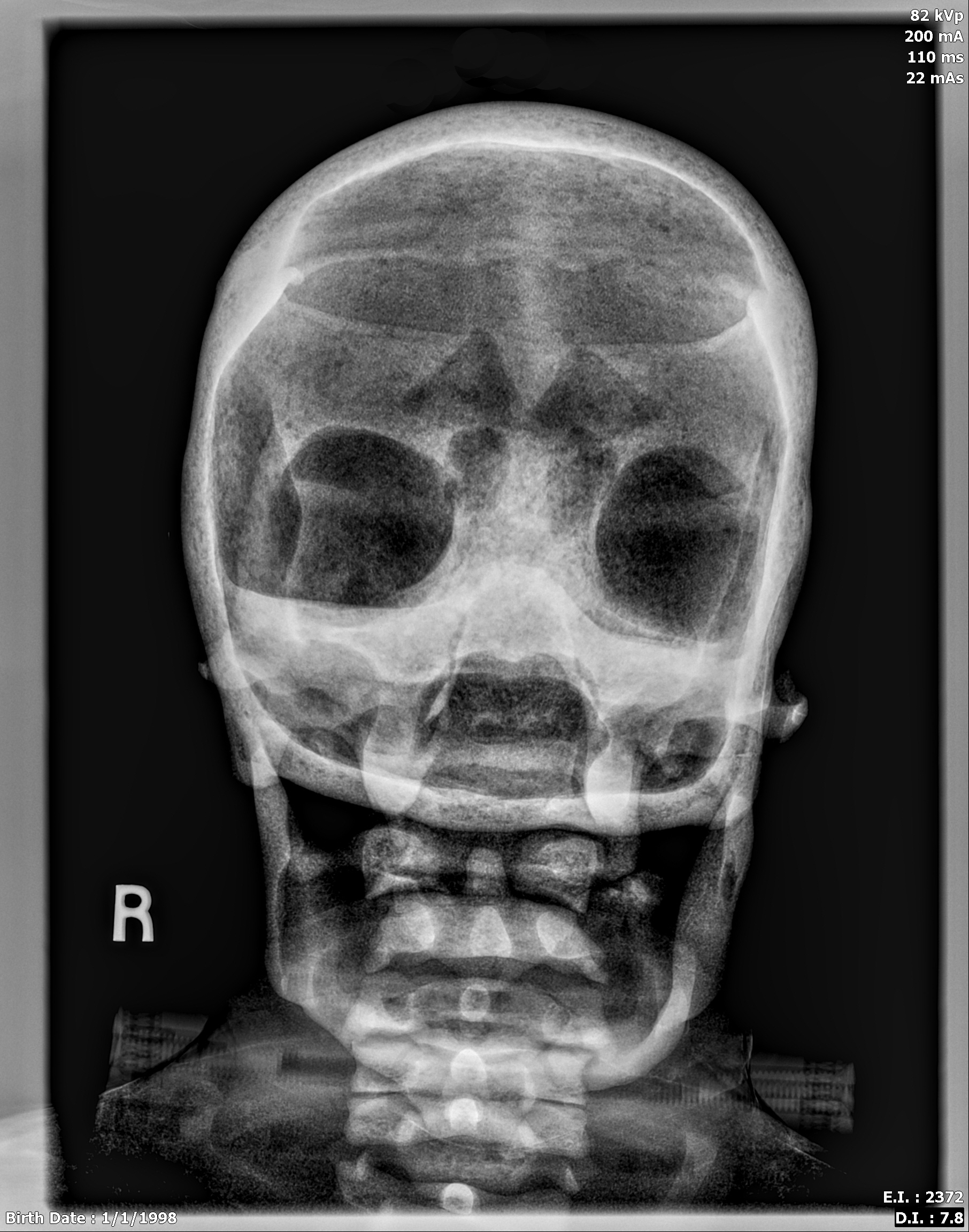 X-Ray Scans