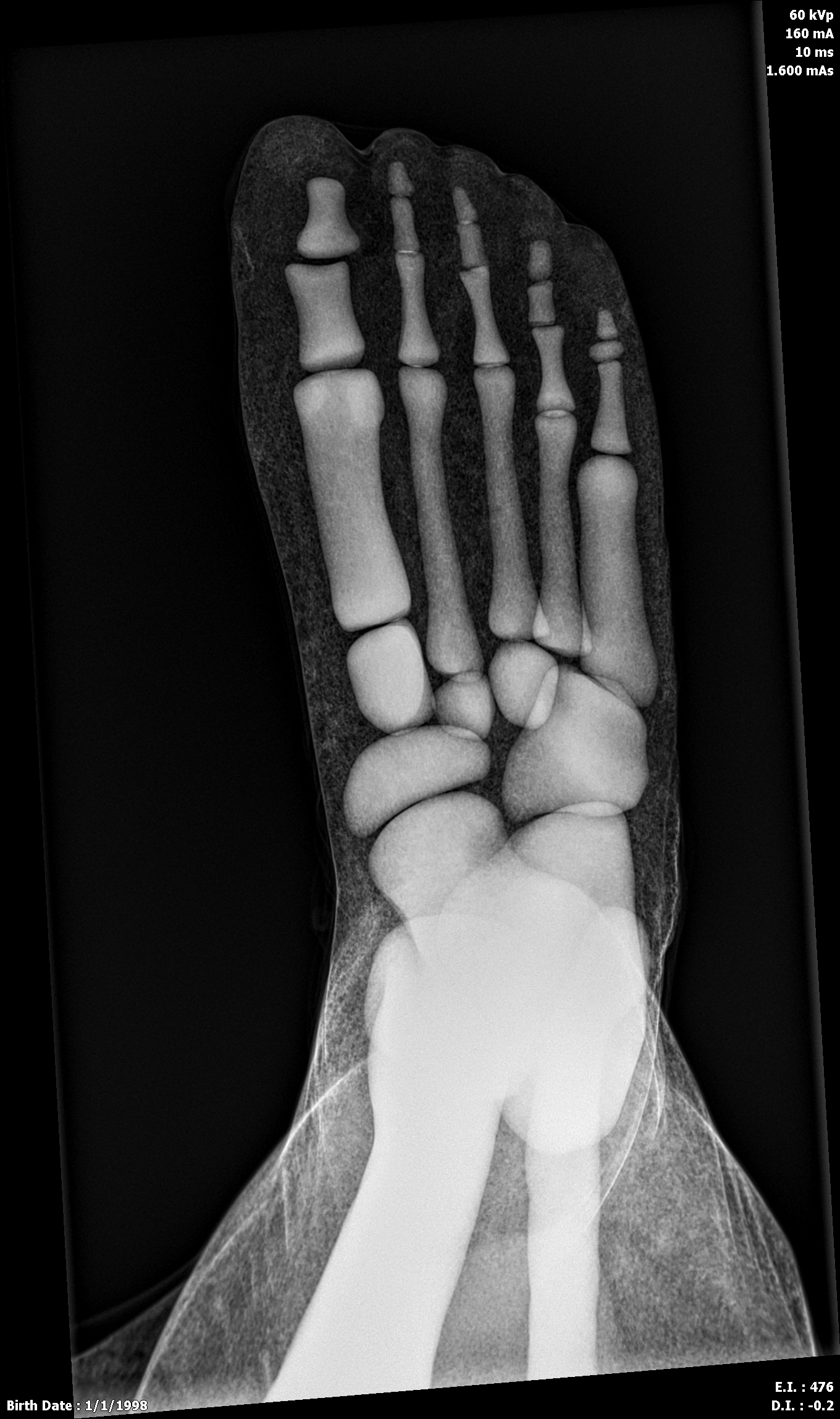 X-Ray Scans