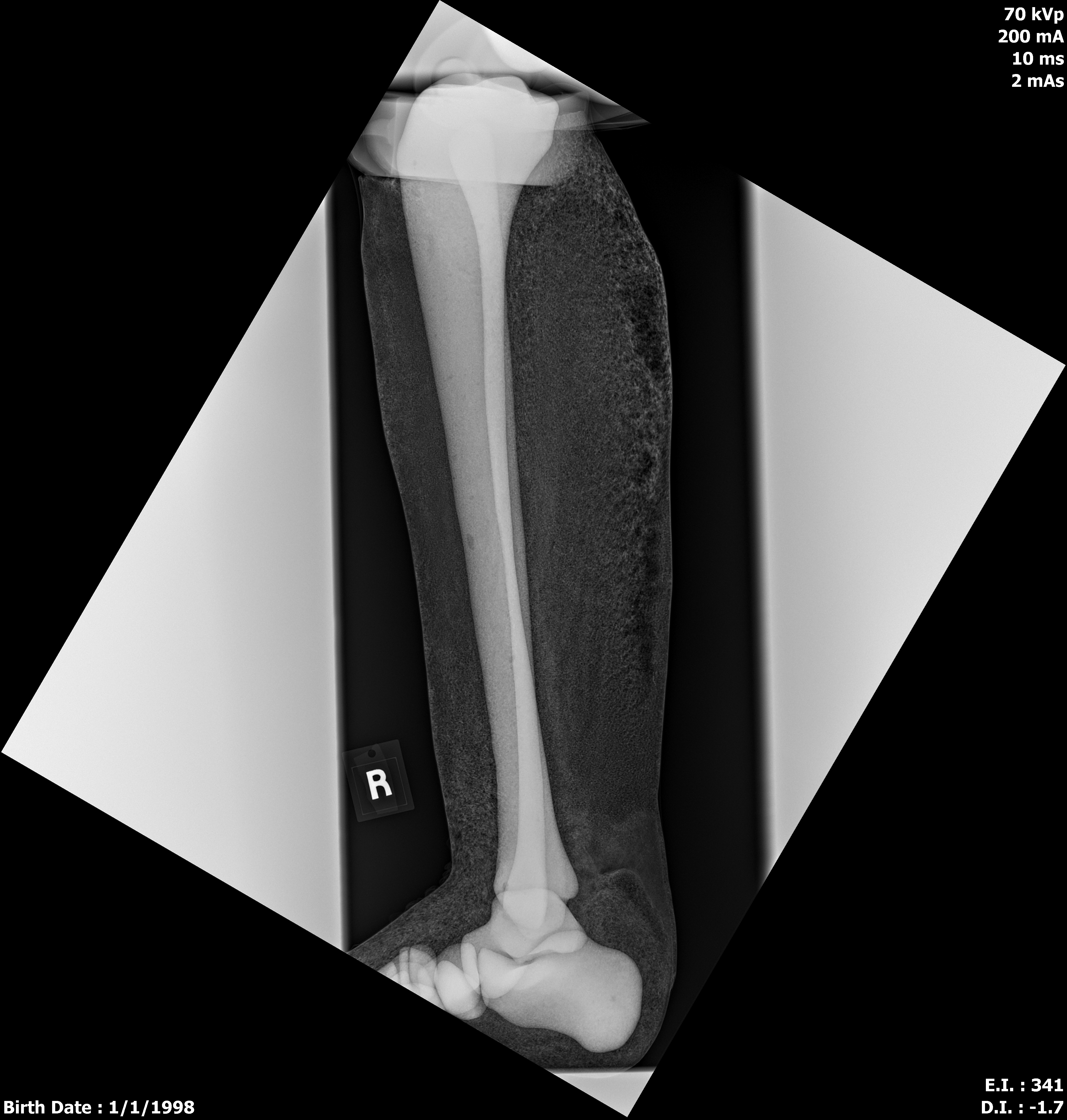 X-Ray Scans