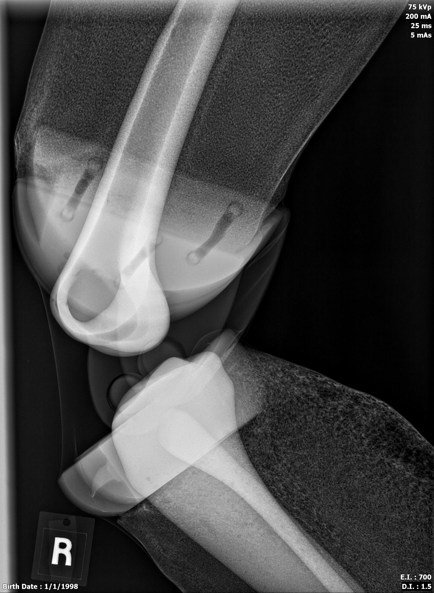 X-Ray Scans
