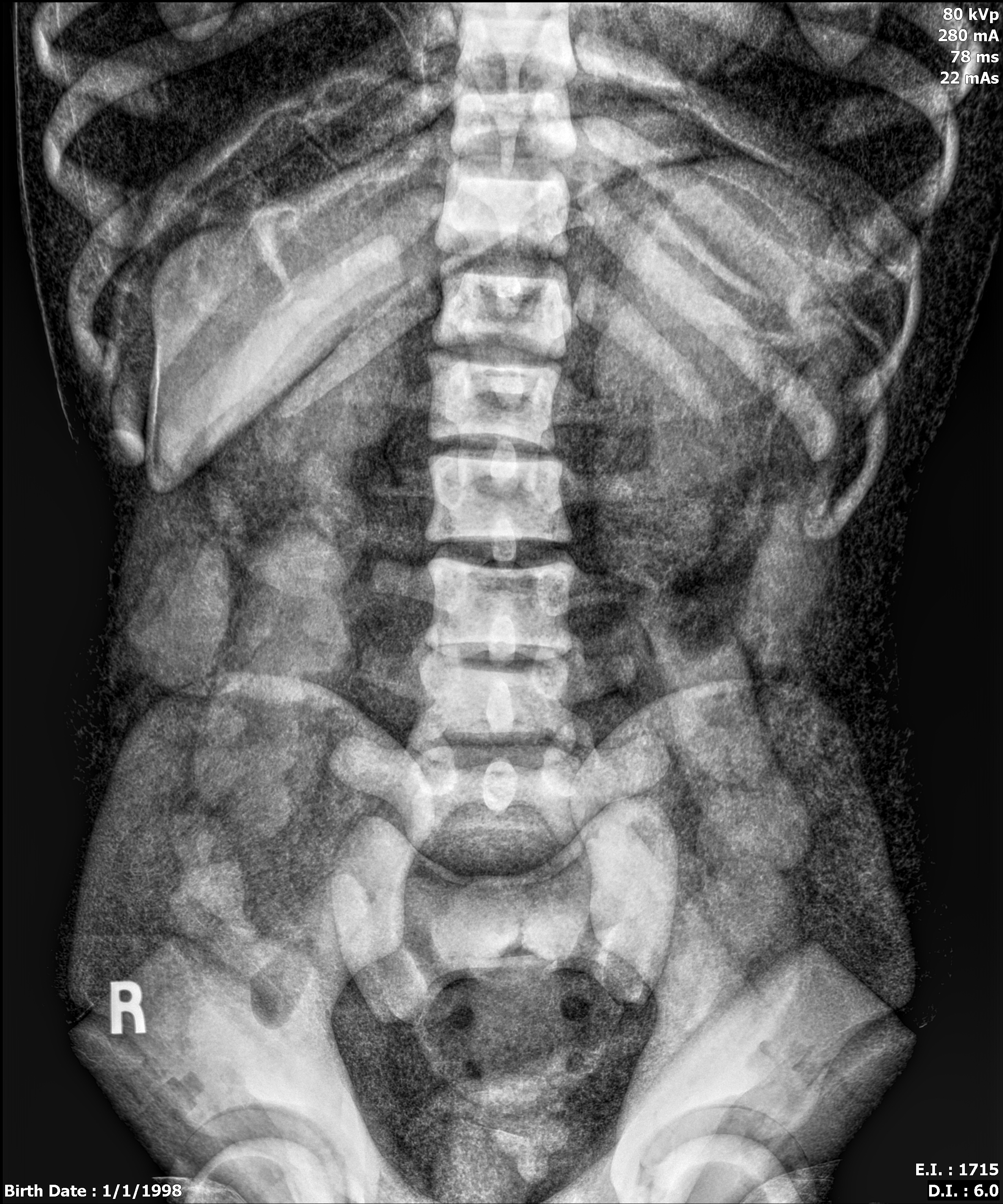 X-Ray Scans