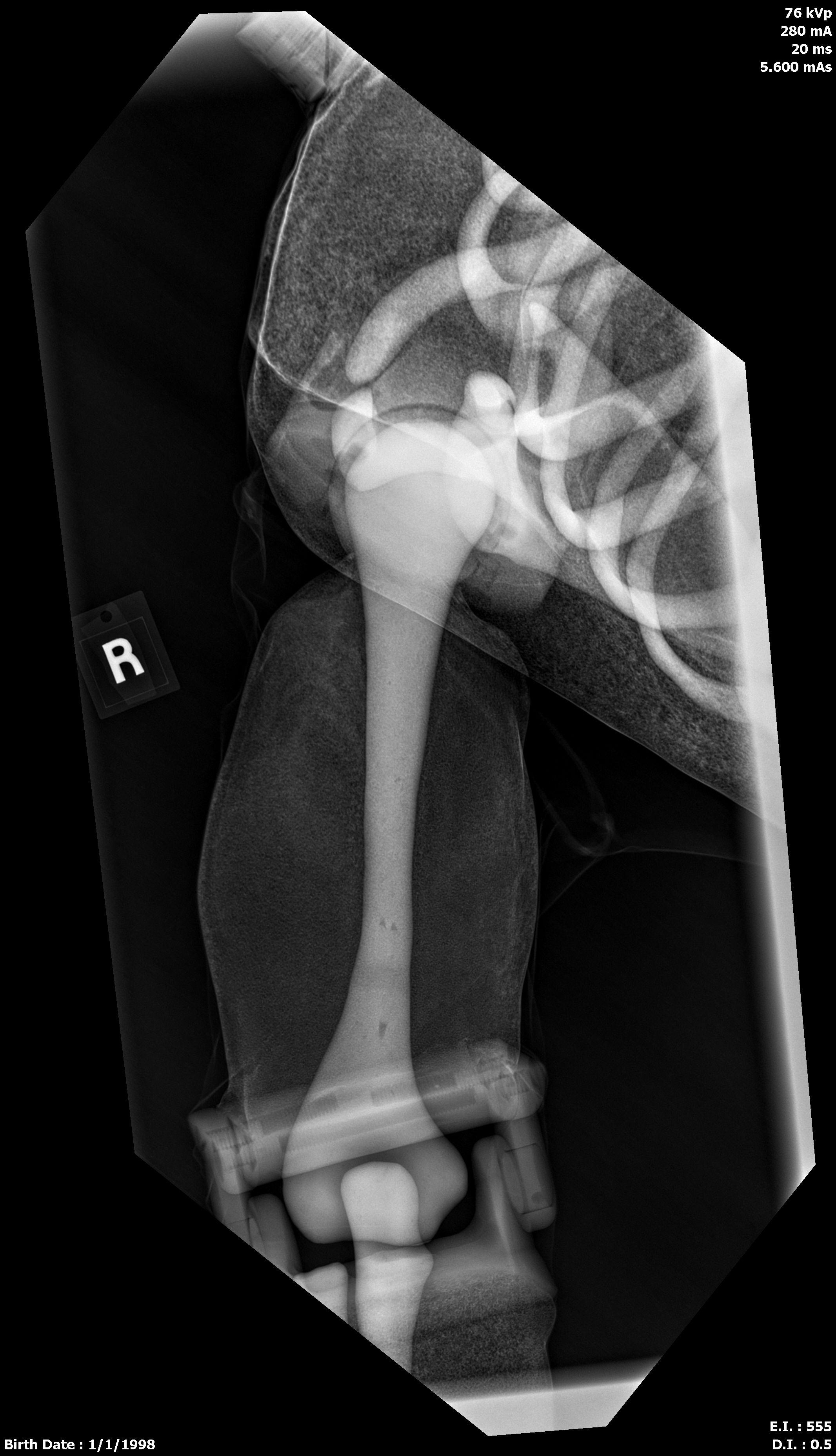 X-Ray Scans