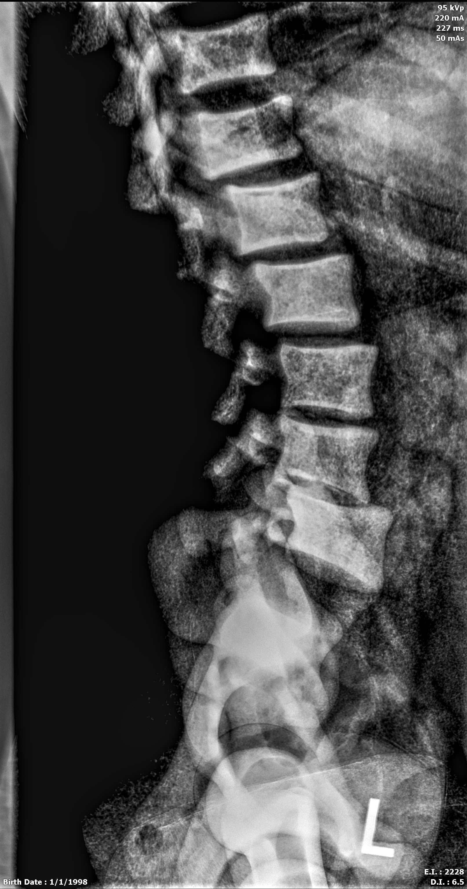 X-Ray Scans