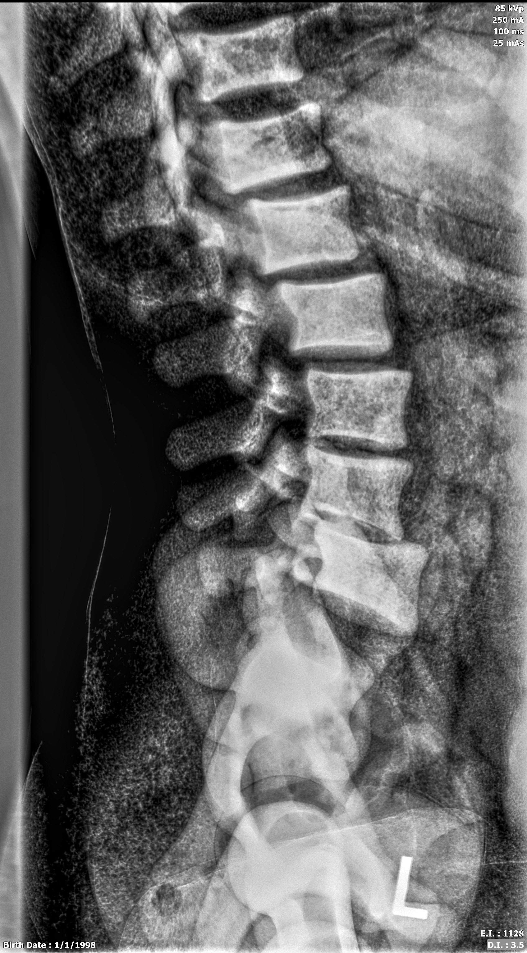 X-Ray Scans