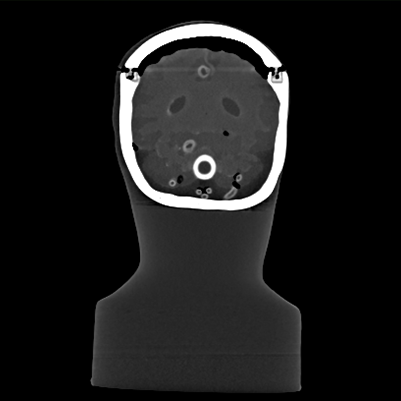 CT Scans