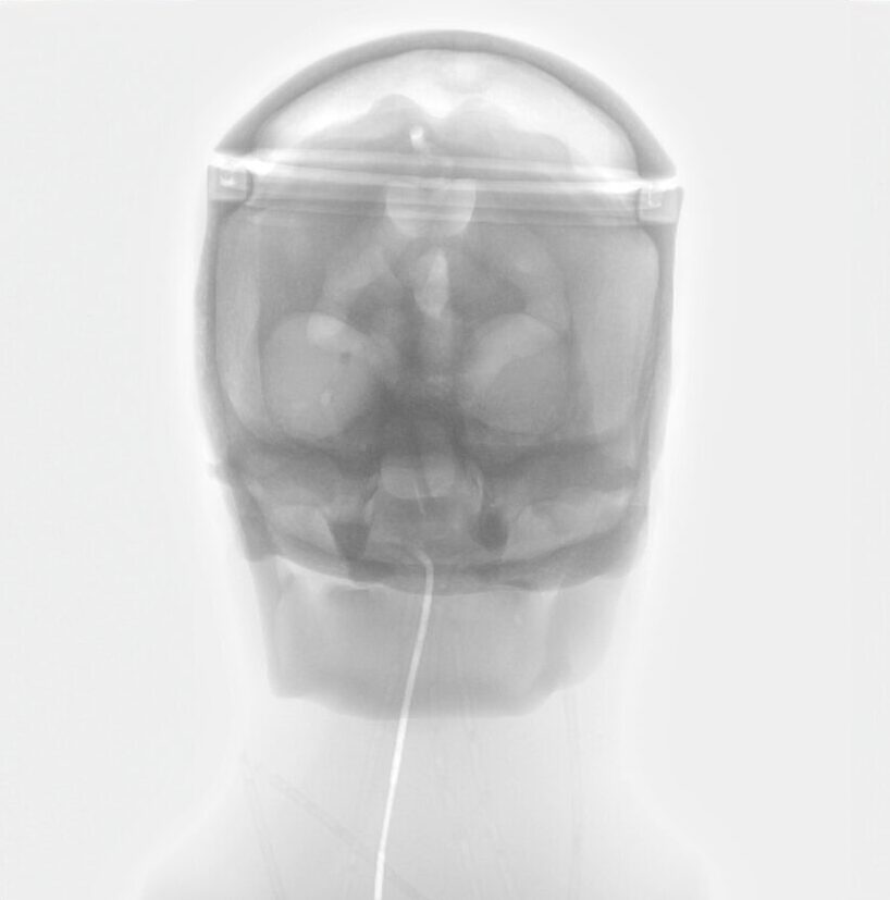 X-Ray Scans