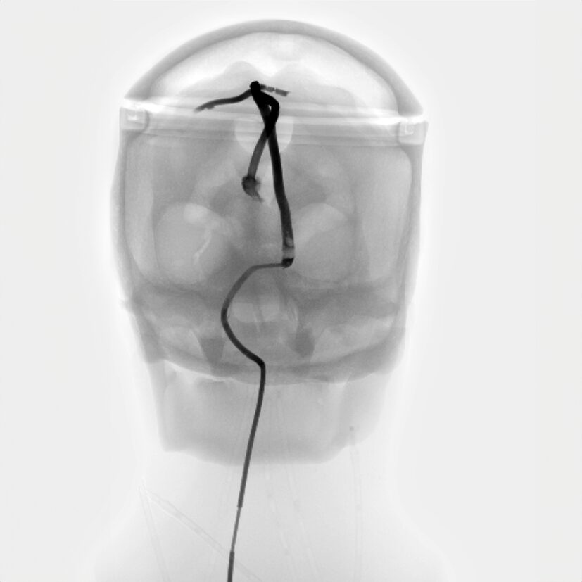 X-Ray Scans