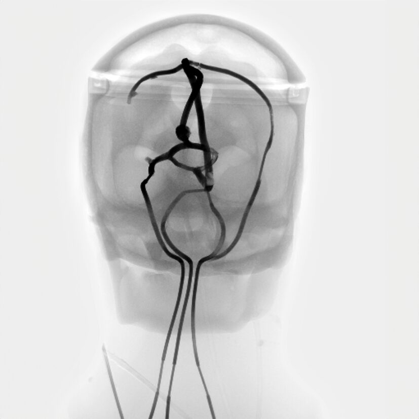 X-Ray Scans