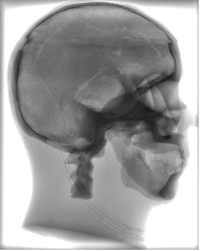 X-Ray Scans