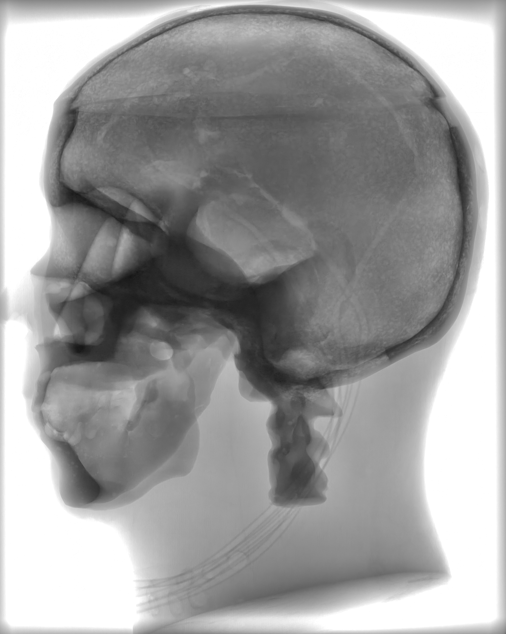 X-Ray Scans