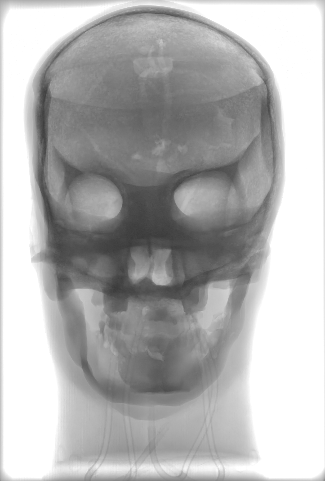 X-Ray Scans