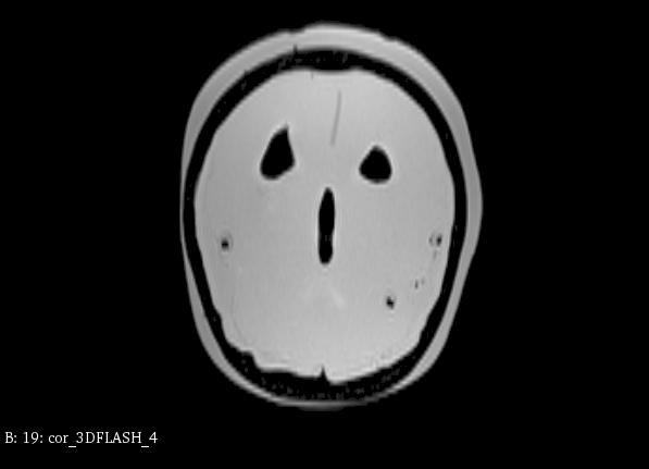 MRI Scans