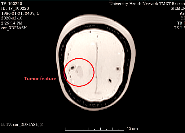 MRI Scans