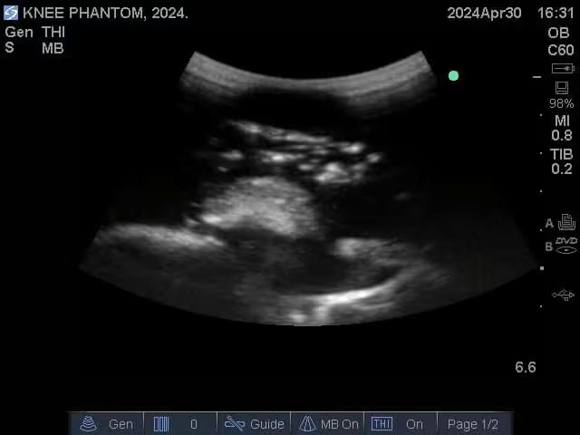 Ultrasound Scans