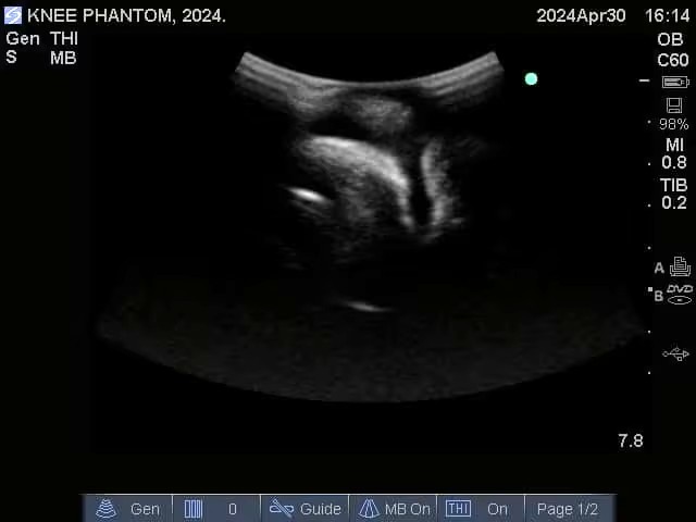 Ultrasound Scans