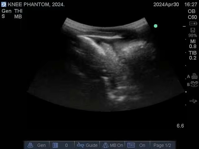 Ultrasound Scans