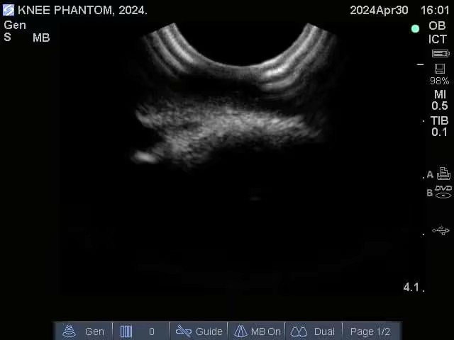 Ultrasound Scans