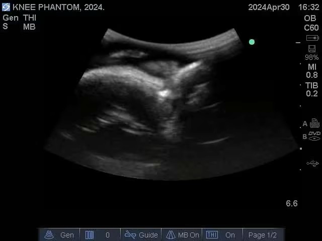 Ultrasound Scans