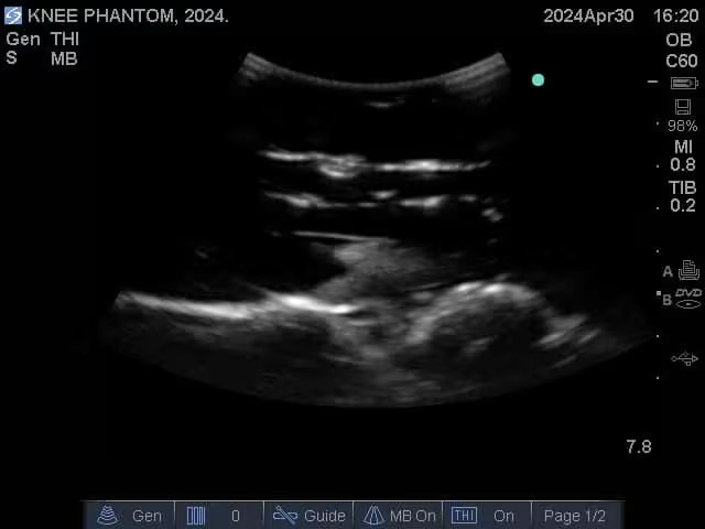 Ultrasound Scans