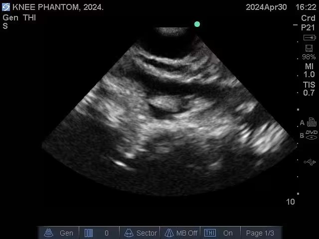 Ultrasound Scans