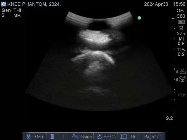 Ultrasound Scans