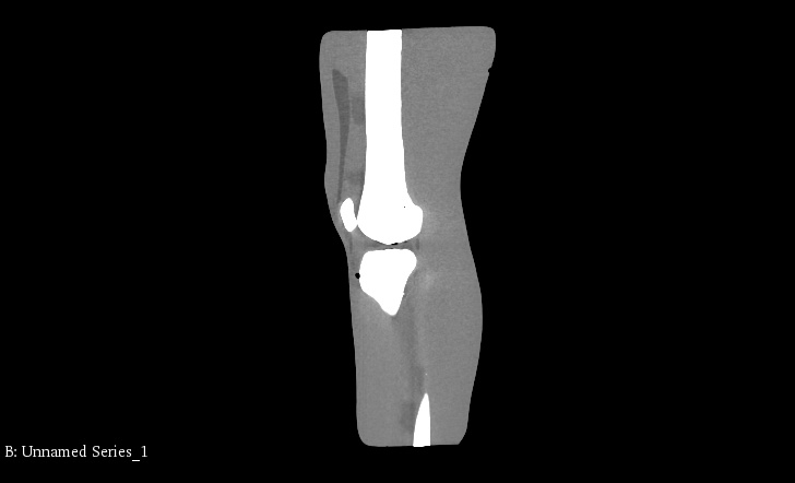 CT Scans