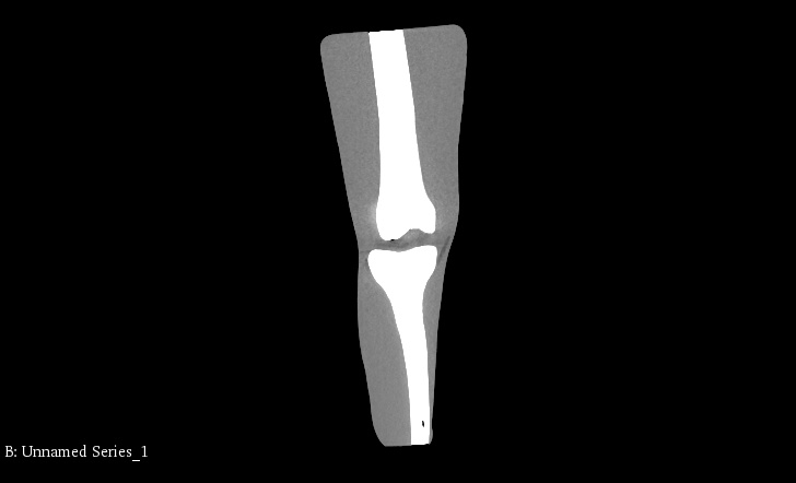CT Scans