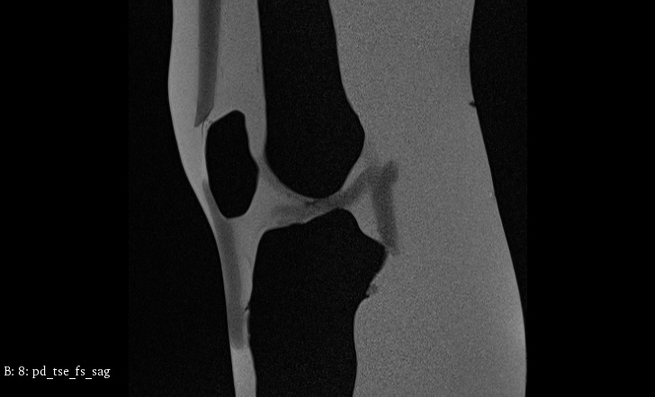 MRI Scans