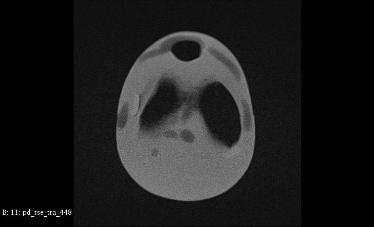 MRI Scans