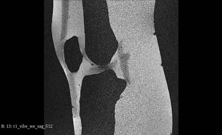 MRI Scans