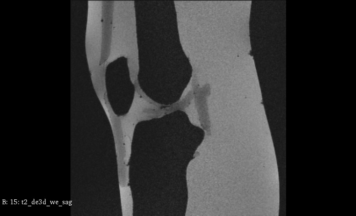 MRI Scans