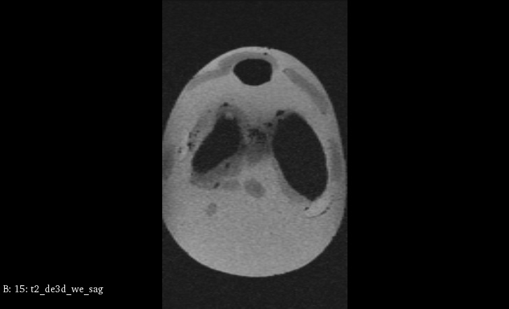 MRI Scans