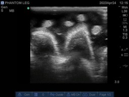 Ultrasound Scans
